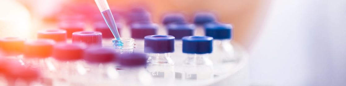 Un científico de Shell vierte líquido en un embudo de plástico en un laboratorio